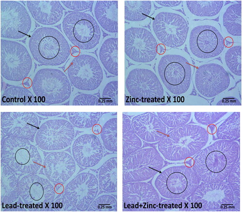 Figure 7. Representative photomicrographs showing the effects of zinc on testicular histoarchitecture in lead-treated male Wistar rats. The vehicle-treated control and zinc-treated rats show preserved testicular histoarchitecture. The seminiferous tubules (black arrow) appear normal in shape and size with normal germ cell lines (red arrow) at varying degrees of maturation. The lumen appears normal with normal mature sperm cells (black circle). The interstitial space also appears normal with intact Leydig cells (red circle). Lead exposure led to alterations in the testicular histoarchitecture. The seminiferous tubules (black arrow) appear reduced and contain sloughed germ cells (red arrow). There are scanty sperm cells within the tubular lumen (black circle). The interstitium appears normal but with degenerated/reduced Leydig cells (red circle). Zinc treatment in lead-exposed rats preserved the testicular histoarchitecture. The seminiferous tubules (black arrow) appear normal in shape and size with normal germ cell lines (red arrow) at varying degrees of maturation. The lumen appears normal with normal mature sperm cells (black circle). The interstitial space also appears normal with intact Leydig cells (red circle).
