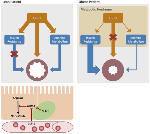 Figure 1 Metabolic pathways in obese patients with asthma: bottom left: GLP-1 delivered in the blood stream and, we hypothesize, secreted from pulmonary neuroendocrine cells (green) modulates arginine metabolism by decreasing ADMA production leading to an increase in nitric oxide (NO) production in airway epithelial cells (orange). Top left: in lean, healthy patients, GLP-1 acts to decrease insulin resistance, relax airway smooth muscle and increase airway NO production. Top right: in asthma patients with obesity and metabolic syndrome, GLP-1 production is decreased, leading to increased insulin resistance, decreased NO production, and increased smooth muscle contractility. All of these features contribute to bronchoconstriction.