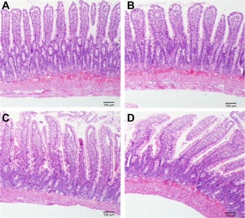 Figure 6 Influences of CNP, SD (AP/CNP ratio of 1:6), and PM (AP/CNP ratio of 1:6) pretreatment on mucosal structures of rats.Notes: (A) control group, (B) CNP group, (C) SD group, and (D) PM group. Magnification, 100×.Abbreviations: CNP, carbon nanopowder; AP, apigenin; SD, solid dispersion; PM, physical mixture.