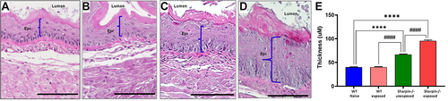 Figure 3 Aspergillus and OVA exposure led to increase epithelial thickening. H&E staining of mouse esophagus showing epithelial thickness in (A) WT naïve, (B) WT exposed, (C) Sharpin-/- unexposed and (D) Sharpin-/- exposed groups, respectively. The blue line indicates the boundary line between the lumen and the submucosa. (E) The thickness of epithelial layer measured using Nikon microscope (10x objective). Values are means ± SD; n=5–7 mice/group. ****p<0.0001 vs WT naïve; ####p<0.0001 vs Sharpin-/- unexposed. Scale- 100µm.