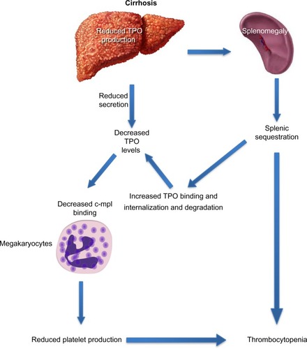 Figure 4 Decreased thrombopoietin levels in cirrhosis lead to decreased platelet production.