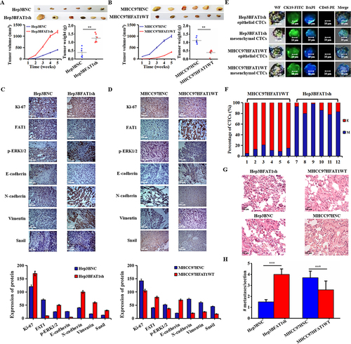 Figure 6 FAT1 knockdown promoted the EMT process and accelerated tumor development in nude mice. (A) FAT1 knockdown promoted tumor growth and significantly increased tumor size (left) and tumor weight (right) in the FAT1 knockdown group compared to the control group. **P < 0.01. (B). Compared with the control group, the tumors in the FAT1-overexpressing group were significantly reduced in size (left) and tumor weight (right). **P < 0.01. (C) Representative IHC staining for Ki-67, FAT1, p-ERK1/2, E-adherin, N-adherin, vimentin and snail from the control group and FAT1 knockdown group (bar, 100 μm). (D) Representative IHC staining for Ki-67, FAT1, p-ERK1/2, E-adherin, N-adherin, vimentin and snail from the control group and FAT1-overexpressing group (bar, 100 μm). (E) Representative CTC images from two groups of mice. (F) ECTC and MCTC count distribution in two groups of mice. (G) Lung metastatic nodules of mice were examined by H&E staining. (H) Average numbers of individual pulmonary metastases. The FAT1-knockdown group had significantly more pulmonary metastases compared to the FAT1-overexpressing group. ***P < 0.001.