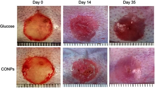 Figure 2 Gross examination images. Cuprous oxide nanoparticles (CONPs)-treated scars improved significantly on gross examination and were softer and less visible compared with their controls group, which gradually became raised, red, and stiff after re-epithelization.