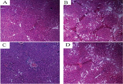 Figure 8. Liver tissues of each SD rat group (HE staining 200×). Normal control group (A); model group (B); COX-2 shRNA-1 group (C); empty vector group (D).