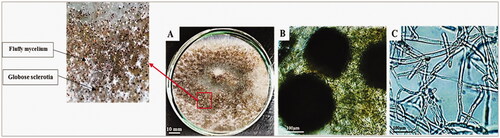 Figure 1. Morphological and microscopic examination of Ceratorhiza hydrophila. (a) growth on Potato dextrose agar media after seven days of incubation at 25ºC, (b) brown globose sclerotia (4X), (c) septate branched mycelium (40×).