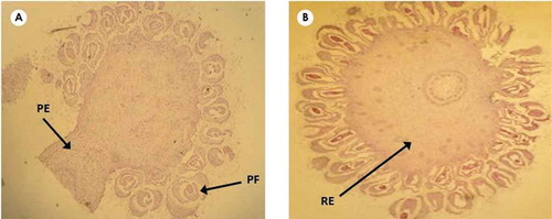 Figure 2. Anatomical structure of inflorescence in longitudinal (a) and transverse (b) views. The structure of peduncle, grown receptacle and flowers without pedicle are seen (PF: pistillate flower; RE: receptacle; PE: peduncle).