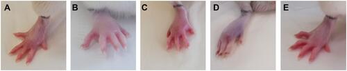 Figure 2 The effects of compounds 10b and 13b on the carrageenan-induced paw edema in rats. Indomethacin was used as a reference drug. Experimental groups: control group (A); carrageenan group (B); group receiving 10 mg/kg indomethacin (C); group receiving 20 mg/kg compound 10b (D); group receiving 20 mg/kg compound 13b (E).