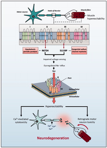 Figure 1 Schematic representation of SCN4A mutations identified in ALS patients. Clinically reported neuromuscular phenotype highlighted in boxes. Identified genetic changes within SCN4A are proposed to lead to motor neuron toxicity by one of two mechanisms: either directly via excessive membrane sodium permeability leading to hyperexcitability and ultimately excitotoxicity; or indirectly via muscle hyperexcitability leading to retrograde motor neuron toxicity.