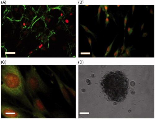 Figure 1. Immunostaining of the BMSCs of the third passage. A, shows the BMSCs labeled with mouse anti-fibronectin monoclonal primary antibody followed by rabbit anti-mouse secondary antibody conjugated with FITC and counterstained with ethidium bromide. B and C were immunostained with anti-CD90 and CD105, respectively. D is a phase contrast image of a neurosphere (scale bar A = 20, B = 20, C = 5, and D = 200 μm).