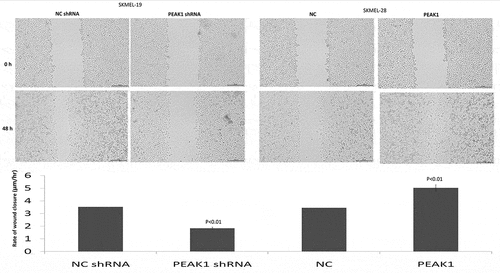 Figure 2. PEAK1 regulates SKMEL19/28 cells migration in vitro by wound healing assay
