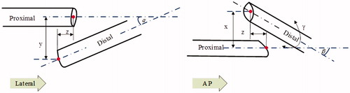 Figure 1. Displacement parameters identified in lateral and AP views.