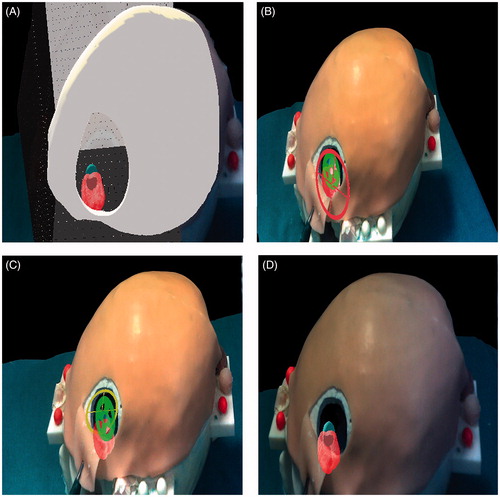 Figure 6. Phase I of the experimental evaluation. Phase I: The four augmented reality visualization modalities as they appear to the user during the evaluation test. A) 3 D grid effect, B) Occluding virtual viewfinders, C) Non-occluding virtual viewfinders, D) Anatomical Occlusions and transparencies.