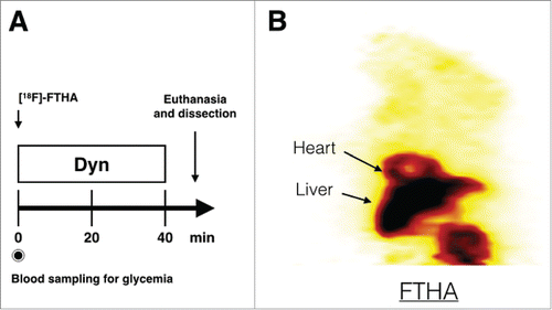 Figure 5. µTEP protocol. Timeline used to observe intravenous uptake of [18F]-FTHA in mice (A) and an example of a coronal slice through the µPET image of FTHA uptake in a WT mouse on a normal diet obtained by this protocol (B). Dyn: Dynamic PET.