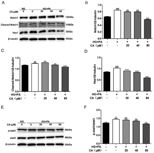 Figure 3. Effect of CA on Notch1 and stat3 signaling pathways in HK2 cells induced by high glucose and high lipid. (A–D) The expression levels of Notch1, Cleaved Notch1, and Hes1 in HK2 cells treated with 20, 40, and 80 μM CA for 24 h were detected and quantified by protein Western blotting; (E–F) the expression levels of stat3 and p-stat3 in HK2 cells treated with 20, 40, 80 μM CA for 24 h were detected by Western blot assay and quantified; Data are presented as means ± SEM; #p < 0.05, ##p < 0.01,###p < 0.001 vs. NG group; **p < 0.01, ***p < 0.001 vs. HG + PA group, n = 3.