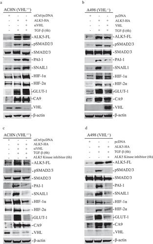 Figure 2. (a) Immunoblots show protein expression of ALK5-full length (ALK5-FL), pSMAD2/3, SMAD2/3, PAI-1, SNAIL1, HIF-1α, HIF-2α, GLUT-1, CA9, and VHL after transfection of indicated vectors in ACHN cells followed by TGF-β stimulation for 6h (n = 3 independent experiments). All protein bands in each lane originated from the same cell lysate. β-actin served as internal loading control; (b) Immunoblots showing protein expression of ALK5-full length (ALK5-FL), pSMAD2/3, SMAD2/3, PAI-1, SNAIL1, HIF-1α, HIF-2α, GLUT-1, CA9, and VHL after transfection of indicated vectors in A498 cells followed by TGF-β treatment for 6h (n = 3 independent experiments). All protein bands in each lane originated from the same cell lysate. β-actin served as an internal loading control. (c) Immunoblots show protein expression of ALK5-full length (ALK5-FL), pSMAD2/3, SMAD2/3, PAI-1, SNAIL1, HIF-1α, HIF-2α, GLUT-1, CA9 and VHL after transfection of indicated vectors in ACHN cells followed by ALK5 specific Kinase Inhibitor (RepSox) treatment, 100 µM for 6h prior to TGF-β stimulation for 6h (n = 3 independent experiments). All protein bands in each lane originated from the same cell lysate. β-actin served as an internal loading control. (d) Immunoblots show protein expression of ALK5-full length (ALK5-FL), pSMAD2/3, SMAD2/3, PAI-1, SNAIL1, HIF-1α, HIF-2α, GLUT-1, CA9 and VHL after transfection of indicated vectors in A498 cells followed by ALK5 specific Kinase Inhibitor (RepSox) treatment, 100 µM for 6h prior to TGF-β stimulation for 6h (n = 3 independent experiments). All protein bands in each lane originated from the same cell lysate. β-actin served as an internal loading control.