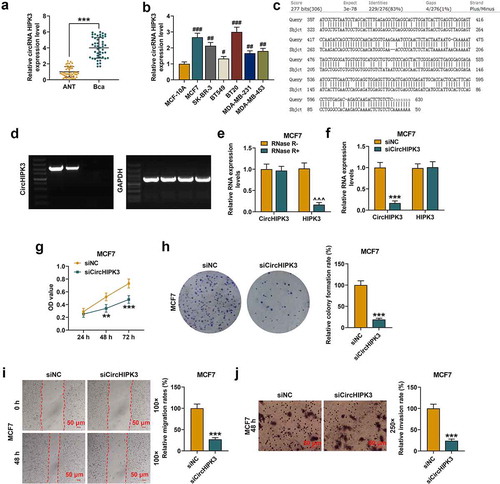 Figure 1. CircHIPK3 knockdown suppressed the malignant biological behaviors of MCF7 cells. (a) The expression of circHIPK3 in BCa tissues and adjacent non-cancerous tissues (ANT) was determined by RT-qPCR. (b) The expression of circHIPK3 in human normal mammary epithelial cell line MCF-10A, and BCa cell lines (MCF7, SK-BR-3, BT549, BT20, MDA-MB-231, MDA-MB-453) was determined by RT-qPCR. (c) CircHIPK3 (has_circ_000284) was located at the second exon of HIPK3 (chr11:33307958–33309057). The highly reverse complementary sequences (83% identity over 200 nucleotides) was found by aligning the sequence of intron 1 to that of intron 2 of the HIPK3 gene. (d) PCR was applied to detect the primers designed for circHIPK3 amplification. (e) The expressions of circHIPK3 and HIPK3 mRNA in MCF7 cells treated with or without RNase R were detected by RT-qPCR. (f) The expression of circHIPK3 in MCF7 cells after transfection with siCircHIPK3 or siNC was determined by RT-qPCR. (g) CCK-8 assay detected the viabilities MCF7 cells with siCircHIPK3 or siNC transfection. (h) Colony formation assay showed the colony formation of MCF7 cells with siCircHIPK3 or siNC transfection. (i) Wound-healing assay detected the inhibited migration of MCF7 cells with circHIPK3 knockdown. (j) Transwell assay detected that the invasion of MCF7 cells with circHIPK3 knockdown was inhibited. **P < 0.01 or ***P < 0.001 vs. siNC; ***P < 0.001 vs. ANT; #P < 0.05 or ##P < 0.01 or ###P < 0.001 vs. MCF-10A. ^^^P < 0.001 vs. RNase R- (without RNase R). GAPDH was used as an internal control. Data are shown as mean±SD, n = 3. BCa: RT-qPCR: reverse transcription-quantitative polymerase chain reaction; NC, negative control; MC, mimic control; M, miR-326 mimic; siCircHIPK3: small interfering circular RNA HIPK3; siNC, small interfering negative control; CCK-8, cell counting kit-8