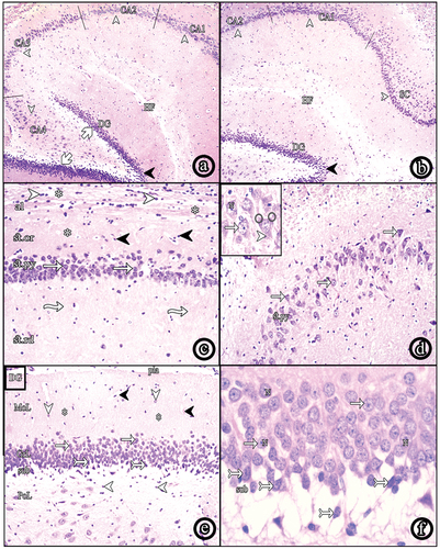 Figure 1. Photomicrographs of paraffin sections in the hippocampus. (a & b) show hippocampus proprius, dentate gyrus (dg) and subiculum (SC); (HF: hippocampal fissure, CA: cornus amonis, blades of DG (white arrows), crest (black arrow heads (H&E, ×40). (c) shows layers of the hippocampus; alveus (al), stratum oriens (st.Or), stratum pyramidale (st.Py) and stratum radiatum (st.Rd); (neuroglial cells (white arrow heads), nerve fibers (asterisks), scattered nuclei (black arrow heads), pyramidal cells (white arrows), radial fibers (wavy arrows) (H&E, ×100). (d) shows CA3 region (H&E, ×100) and the inset shows a higher magnification of pyramidal cells (white arrows) with vesicular nuclei (N), apical dendrite (arrow head) and basal dendrites (round shape) (H&E, ×400). (e) shows layers of the DG; the molecular layer (MoL), the granule cell layer (GrL) and the polymorphic layer (PoL); (pia matter (pia), blood vessels (black arrow heads), scattered nuclei (arrow heads), nerve fibers (asterisks), granule cells (white arrows), immature cells (tailed arrows), the subgranular zone (sub) (H&E, ×100). (f) shows a higher magnification of granule cells (white arrows) with vesicular nuclei (N). Spindle-shaped immature cells (tailed arrows) appear in the subgranular zone (H&E, ×400).