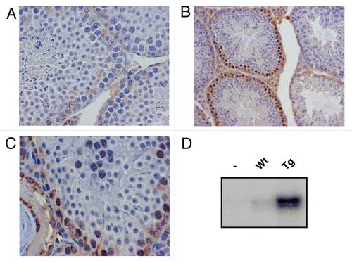 Figure 2 Exogenous cyclin E is expressed in testicular germ cells and increases Cdk2 kinase activity. (A–C) Detection, by immunohistochemistry on mouse testis sections, of human cyclin E expression (brown nuclei) in transgenic mice (B and C) and wild-type (A) littermates (A, C: 630x; B: 400x). (D) In vitro kinase activity toward histone H1 of human cyclin E immunoprecipitates from hcyclin ET62A, T380A transgenics or wild-type littermates.