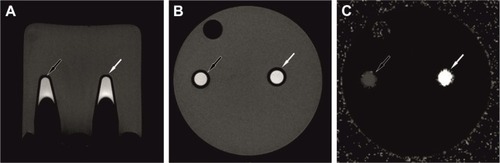 Figure 7 In vitro MR imaging of Molday ION-tracked hBM-MSC-EVs (black arrow) and nonlabeled hBM-MSC-EVs (white arrow) in phantom experiment.Notes: EV tubes were placed in agar gel (A). No obvious change was visible on echo T2-weighted MR images (B). The change in relaxation time was detected by T2-map (C).Abbreviations: EVs, extracellular vesicles; hBM-MSC, human bone marrow mesenchymal stem cell.