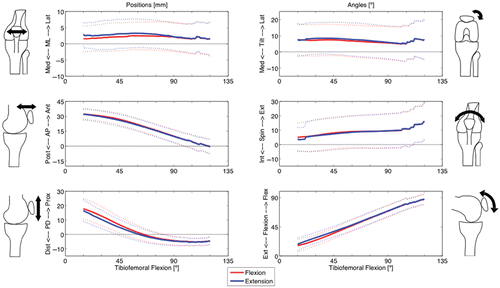 Figure 6. The six degrees of freedom of pre-arthroplasty kinematics are shown relative to tibiofemoral flexion for both the flexion and extension phases (mean and standard deviation). On average, the patella tracked slightly laterally (upper left), with lateral tilt (upper right) and external spin (mid right). The other translations and rotation (AP, PD and flexion) were primarily controlled by the joint geometry (see Figure 5). [Color version available online.]