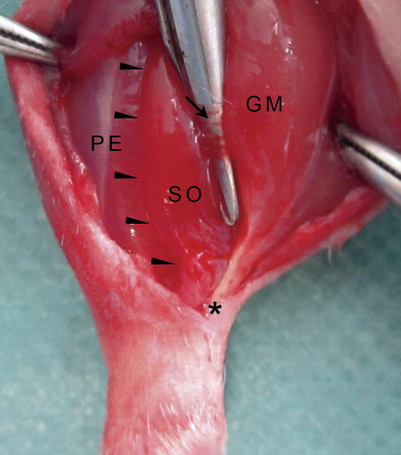 Figure 1. Innervation of soleus muscle and vascular supply. Arrowheads: lateral border of soleus muscle (SO); arrow: neurovascular bundle coming from the gastrocnemius muscle (GM) and entering at the medial border of the SO, the tip of the arrow indicating the soleus nerve; PE: peroneal muscles. The asterisk shows the Achilles tendon.