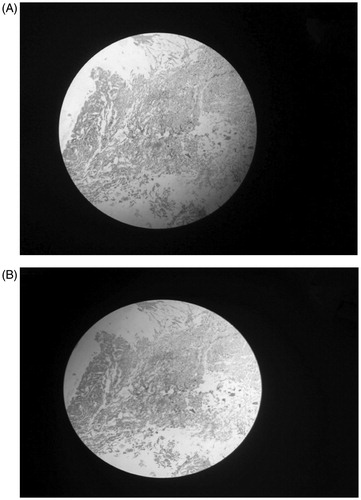 Figure 5. Microscopic images of normal nasal mucosa (A) and nasal mucosa after applying nanoformulation for 8 h (B).