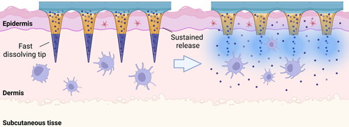 Figure 4. Representative scheme of a transdermal microneedle delivery system. A biphasic delivery system comprises a fast-dissolving biodegradable polymer tip, as the case of HA, which rapidly leads to the release of the desired molecule/proteins into the dermis or epidermis, followed by a slower biodegrading base that contributes to sustained release overtime.