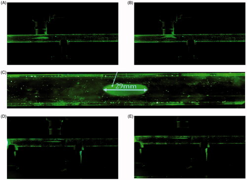 Figure 5. In-vitro magnetic targeting. (A) Drug carriers aerosolized with a brine solution of 10:1 DI water:NaCl into a 16.8 mm inner diameter hollow tube. The airflow was set at 1.145 L/min. The magnet was placed 0 mm from the hollow tube. The aerosol bolus was calibrated to stop directly below the magnet. (B) The aerosol bolus was attracted towards the magnet. (C) The deposited aerosol bolus onto the inner wall of the hollow tube. The elliptical width was measured at 29 mm. (D) Experiment with magnet placed 10 mm from the hollow tube. (E) Experiment with magnet placed 20 mm from the hollow tube.