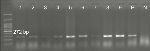 Figure 2 Detection of CP44 gene (272 bp) in Pseudomonas aeruginosa isolates.Note: Molecular pattern: 100 bp.Abbreviations: N, negative control; P, positive control.