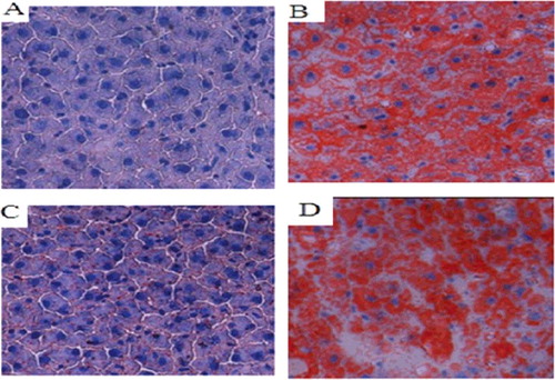 Figure 7. Changes in lipid droplets in the liver tissues of the SD rat groups (Sudan IV staining, 400×). Normal control group (A); model group (B); COX-2 shRNA-1 group (C); empty vector group (D).