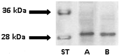 Figure 2. Western blot of kidney extracts from chicken (lane A) and quail (lane B) stained with anti-chicken CAII. Lane ST, molecular weight standards.