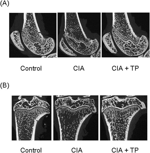 Figure 4. Effect of triptolide on periarticular bone erosion in knee joints. Images show bones of (A) femur and (B) tibia. CIA: collagen-induced arthritis rats treated with sterilized saline. CIA + TP: collagen-induced arthritis rats treated with triptolide.