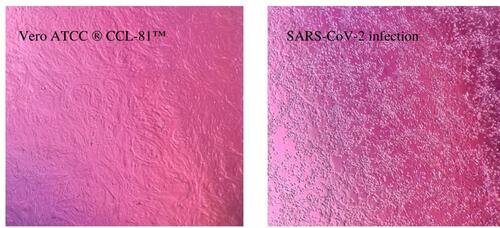 Figure 1 SARS-CoV-2 infection in cell culture. On the left, an uninfected cell line; on the right: SARS-CoV-2 infection in cell culture of Vero ATCC CCL-81 (Fiocruz, BR).