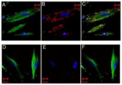 Figure 1 Immunofluorescent images. The first set is the positive immunofluorescent image for the invasion of CNPs and colocalization. The second set is the negative control. A, D) The green-conjugated secondary antibody recognized HDPCs and the Hoechst staining for blue-labeled nuclei of HDPCs. B, E) The blue-labeled nucleus of HDPCs and the red-conjugated secondary antibody recognized CNPs. C, F) The merged images of the above three colored signals. The invasion of CNPs on the cells is shown in C. The red-labeled particles stick to the outer membranes of the cells or invade a specific site in the cytoplasm, or even enter the nucleus of the cells. In the negative control (E), the red-conjugated CNPs were seldom seen and were distributed in the noncell region. The merged view of (F) shows the red signals had totally disappearedAbbreviations: CNPs, calcifying nanoparticles; HDPC, human dental pulp cell.