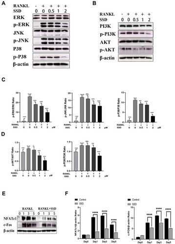 Figure 5 Saikosaponin D attenuated RANKL-induced activation of MAPKs and PI3K-AKT pathways. (A and B) SSD suppressed the phosphorylation and activation of JNK, ERK, P38, AKT and PI3K induced by RANKL. (C and D) The expressions of p‐ERK, p-JNK, p-P38, p-AKT and p-PI3K relative to total cellular proteins. (E) SSD suppressed RANKL-induced activation of NFATc1 and c-FOS. Immunoblot analyses were performed on total proteins extracted from BMMs treated with SSD and RANKL for 0, 1, 3, or 5 days. (F) The expressions of NFATc1 and c-FOS relative to β-actin. Mean ± SD is used to describe the data. Above experiments were conducted independently at least 3 times. ****P <0.0001, ***P<0.001, *P <0.05.