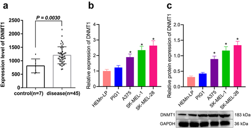 Figure 1. Expression of DNMT1 in melanoma. a: Screening of differentially expressed genes in human melanoma and normal skin tissue samples in melanoma-related microarray dataset GSE3189; b: RT-qPCR measurement of DNMT1 mRNA expression in three melanoma cell lines (A375, SK-MEL-1 and SK-MEL-28) and two human normal melanocytes (PIG1 and HEMn-LP) cell lines; c: Western blot analysis of DNMT1 protein expression in three melanoma cell lines (A375, SK-MEL-1 and SK-MEL-28) and two human normal melanocytes (PIG1 and HEMn-LP) cell lines. Measurement data were characterized as mean ± SD. The comparison between data of two groups was performed by independent sample t test, and that among multiple groups was performed utilizing one-way ANOVA with Tukey’s post-hoc test. All experiments were repeated three times. *p < 0.05 versus the Normal/Control group or HEMn-LP cells.