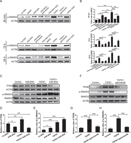 Figure 9. SMAD3 reduced the expression of TFEB under diabetic conditions. (A and B) Western blot analysis of phospho-SMAD3 expression in HK-2 cells. The cells were pretreated with 10 µM galunisertib or 10 µM SIS3 for 1 h and then exposed to AGE-BSA or TGFB1 for another 30 min, 12 h, or 24 h. (C–E) Western blot analysis of TFEB and phospho-SMAD3 expression in HK-2 cells. The cells were stimulated with AGE-BSA, TGFB1, AGE-BSA, and TGFB1 for 24 h. (F–H) Western blot analysis of TFEB and phospho-SMAD3 expression in HK-2 cells. The cells were pretreated with 10 µM galunisertib for 1 h and then exposed to TGFB1 for another 24 h. Data represent the means ± SEM for at least 3 independent experiments. *P< 0.05, **P< 0.01, and ***P< 0.001