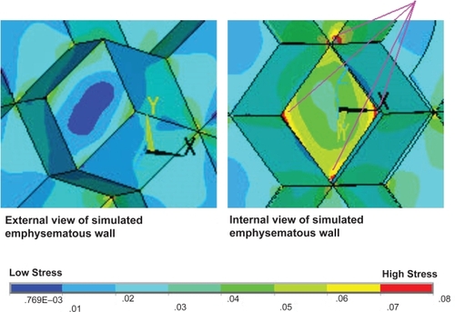 Figure 7 A close up view of the simulated emphysematous wall incorporating the elevated internal pressure. Highlighted, is the significantly elevated stress levels at the internal junctions with the adjoining alveolar walls.