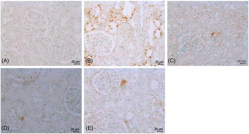Figure 3.  Effects of Mel and VD3 treatment on apoptosis induced by renal I/R. Apoptosis was evaluated by TUNEL staining (Brown nuclei). (A) Control group, (B) I/R group, (C) Mel + I/R, (D) VD3 + I/R, and (E) Mel + VD + I/R group. Bar = 20 μm.