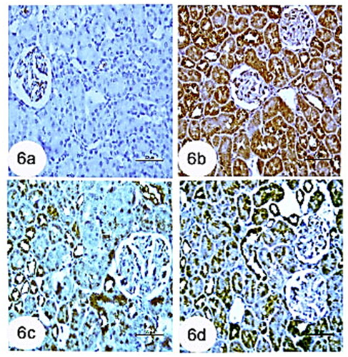 Figure 6. Photomicrographs from immunohistochemistry of kidney section of rats showing (a): control group with negative immunoreaction for TNF-α in renal tubules. (b): Group CCl4 showing strong positive immunoreaction for TNF-α in tubular cells of kidney. (c): CCl4 + rats BM-MSCs and (d): CCl4 + mice BM-MSCs showing poor immunoreaction for TNF-α in tubular cells of the kidney. (Immunostaning for TNF-α; Scale bar of a–d = 50 µm).