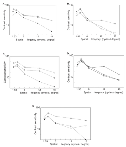 Figure 7 Contrast obtained with various bifocal CL. Results obtained by measurement of contrast while wearing bifocal CL using a multivision contrast tester (MCT8000, Vistec Inc). Distant vision during the daytime (○), near vision during the daytime (●), and near vision at night (▴). Data obtained at the time of wearing glasses were used as control values. A Eye glasses (control); B Simultaneous, Nonspherical type (RGP): Expert®; C Simultaneous, Nonspherical type (RGP): Clair®; D CL in which the optical axis coincides with the line of sight (SCL): E Menifocal soft®; Simultaneous, Concentric type (SCL): ForView®.