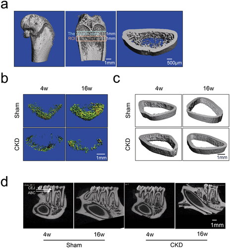 Figure 3. Effects of CKD–MBD on the femoral and alveolar bones of rats by micro-CT scanning in the CKD and sham groups at 4 and 16 weeks. a, The region of interest (ROI) and representative three-dimensional reconstruction images in the femur. An area of 1 mm below the growth plate where the growth plate had disappeared was scanned as the starting point. The scanning field continued for 1 mm as the endpoint of the ROI. b, The representative microarchitecture images of trabecular bone in femur in the CKD and sham groups. c, The representative microarchitecture images of cortical bone in femur in the CKD and sham groups. d, The representative images of alveolar bone on cementoenamel junction (CEJ) to the alveolar bone crest (ABC) distance in the distal of the mandibular first molars in the CKD and sham groups. N = 3 for each group. The scale bar ranges from 500 μm to 1 mm.