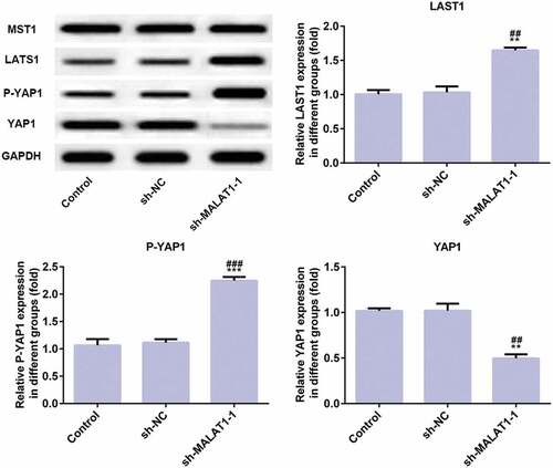 Figure 4. LncRNA MALAT1 interference inhibits proliferation and adhesion of myeloma cells through Hippo-YAP signaling pathway. The proteins (MST1, LATS1, P-YAP1, and YAP1) related to Hippo-YAP signaling pathway were detected by western blot. **P < 0.01 and ***P < 0.001 vs. control group. ##P < 0.01 and ###P < 0.001 vs. sh-NC group