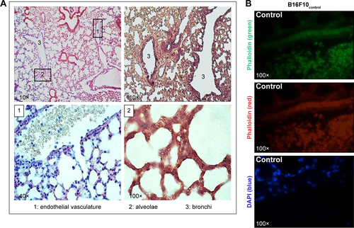 Figure S5 Controls of histological assays: fluorescence signals due to rQDs-GSH or Calcein were followed in lungs 6 hours post-injection of unlabeled B16F10 cells. Notes: (A) Light microcopy images of histological sections from lungs collected 6 hours post-injection of unlabeled B16F10 cells and stained with hematoxylin and eosin. Images show various tissue areas where B16F10 cells were identified. (B) Confocal images of histological sections from lungs collected 6 hours post-injection of unlabeled B16F10 cells. Phalloidin green, red, and DAPI were used as a contrast media. No signals related to rQDs-GSH or Calcein were observed.Abbreviations: GSH, glutathione; QDs, quantum dots; rQDs-GSH, red QDs-GSH.