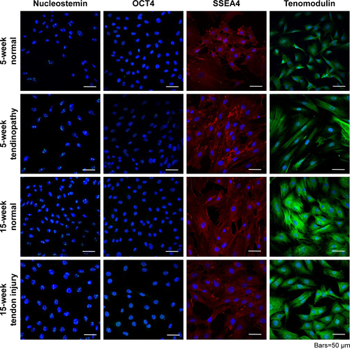 Figure S2 Isolation of TDSCs was validated by identifying cells that positively stained for nucleostemin, OCT4, SSEA4, and tenomodulin. Each TDSC cell line was successfully differentiated into osteogenic, adipose, and chondrogenic cell lines, demonstrating their multipotent capacity.Abbreviation: TDSCs, tendon-derived stem cells.