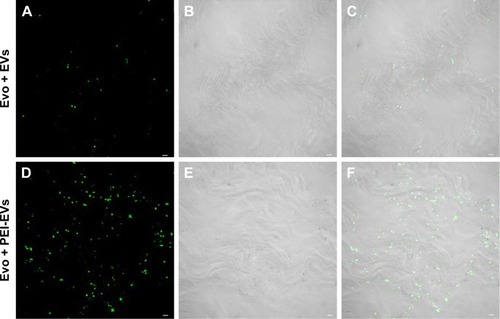Figure 3 Confocal laser-scanning microscopy showing Evo coated with EVs and PEI-EVs.Notes: (A) Stained EVs (green) seeded on the Evo membrane. (D) Stained-PEI-EVs (green) seeded on the Evo membrane. Microphotography confirmed the presence of EVs on the Evo surface. (B and E) The light-transmission channel shows Evo morphology (gray). (C and F) Merged images of the aforementioned channels. Microphotography confirmed the presence of PEI-EVs on the Evo surface. PEI-EVs and EVs showed the same capacity to cover the Evo surface. Scale bars =10 μm.Abbreviations: EVs, extracellular vesicles; PEI, polyethylenimine; Evo, Evolution.