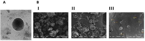 Figure 5 Transmission electron microscopy of F4 -SLNs (A) and scanning electron microscopy (B) images of (I) MZL, (II) GMS lipids, and (III) F4- SLNs.