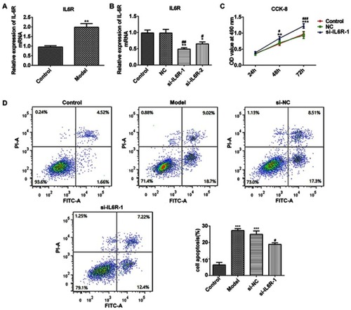 Figure 3 Effect of IL6R on the viability and apoptosis of glucose-induced INS-1E cells. (A) IL6R expression in the glucose-induced INS-1E cells. (B) IL6R expression in different groups, as detected by reverse transcription-quantitative PCR. (C) Cell viability represented as OD values in different groups. (D) Apoptosis of INS-1E cells in different groups and proportion of apoptotic cells. **P<0.01 and ***P<0.001 vs control group. #P<0.05 and ##P<0.01 and P<0.001 vs NC group.