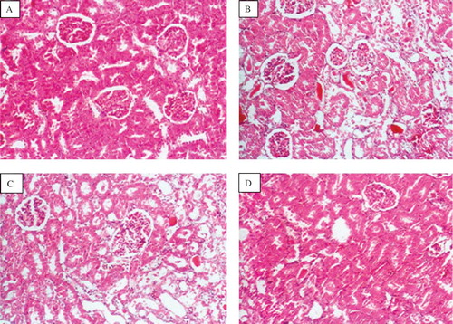 Figure 5.  Photomicrographs of kidney sections of rat stained with haematoxylin and eosin (×100). (A) Haematoxylin- and eosin-stained sections of normal rat kidneys. (B) Kidney section of CIS-treated rats showing tubular brush border loss and necrosis of epithelium. (C) Kidney section of CIS + EEA, 50 mg-treated rats showing prevention of CIS-induced alterations. (D) Kidney section of CIS + EEA, 100 mg-treated rats showing prevention of CIS-induced alterations.