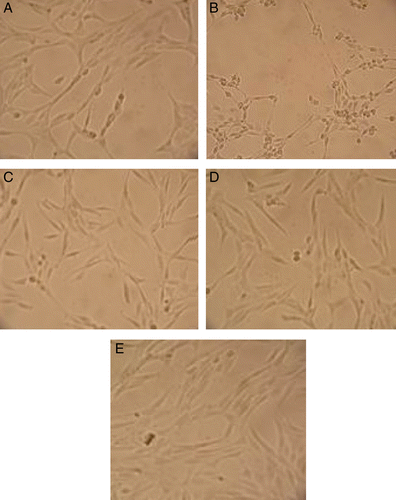Figure 3.  Effects of compounds 4, 13 and positive control on PC 12 cell injury induced by H2O2. (A) PC 12 control cells. (B) PC 12 cells exposed to 600 μM of H2O2 for 3 h. Most of the cells become round shapes. The membrane lesion of cells was also observed. (C, D and E) PC 12 cells were pre-incubated with 20 μg/mL of compounds 4, 13 and quercetin, respectively before exposed to 600 μM H2O2 for 3 h.